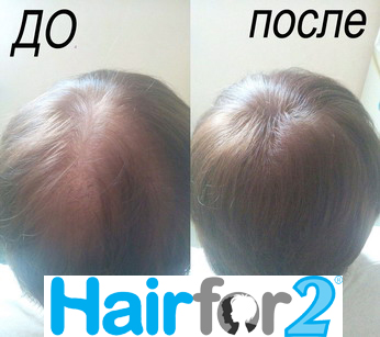 THE NEW GENERATION HAIRFOR2    -    